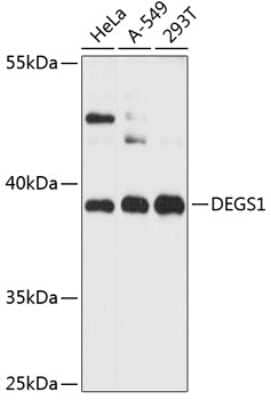 Western Blot: DEGS1 AntibodyAzide and BSA Free [NBP2-92082]