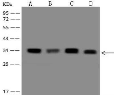 Western Blot: DEGS1 Antibody [NBP3-12689]