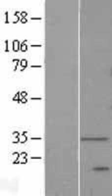 Western Blot: DEGS1 Overexpression Lysate [NBP2-07967]