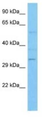 Western Blot: DEGS2 Antibody [NBP3-10844]