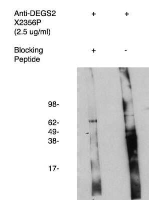 Western Blot: DEGS2 Antibody [NBP3-11918]