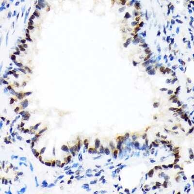 Immunohistochemistry-Paraffin: DEK Antibody (2C2V8) [NBP3-15257]