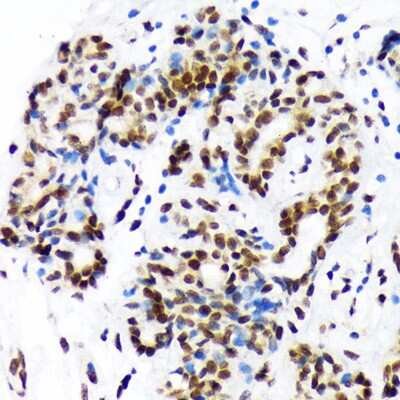Immunohistochemistry-Paraffin: DEK Antibody (2C2V8) [NBP3-15257]