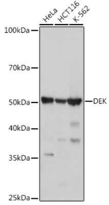 Western Blot: DEK Antibody (2C2V8) [NBP3-15257]