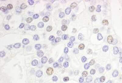 Immunohistochemistry-Paraffin: DEK Antibody [NB100-61057]