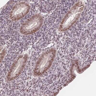 Immunohistochemistry-Paraffin: DEK Antibody [NBP2-49135]