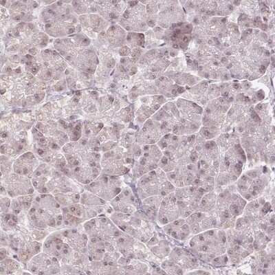 Immunohistochemistry-Paraffin: DEK Antibody [NBP2-49135]