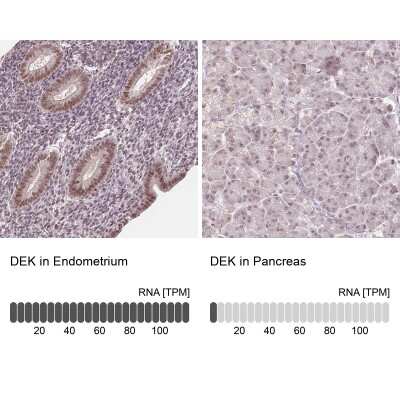 Immunohistochemistry-Paraffin: DEK Antibody [NBP2-49135]
