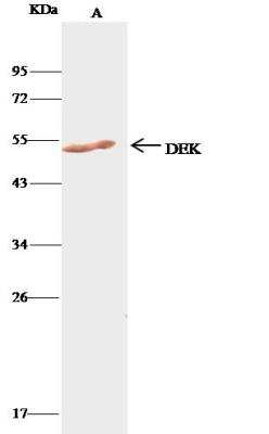Immunoprecipitation: DEK Antibody [NBP2-98888]