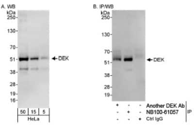 Western Blot: DEK Antibody [NB100-61058]