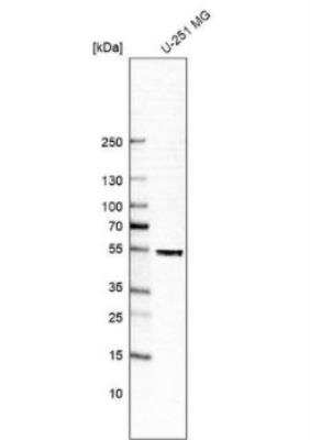 Western Blot: DEK Antibody [NBP2-38834]