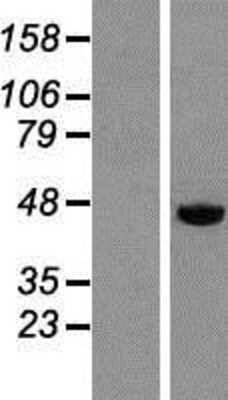 Western Blot: DEK Overexpression Lysate [NBP2-08003]