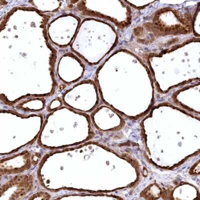Immunohistochemistry-Paraffin: DELGEF Antibody [NBP1-88025]