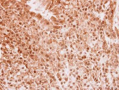 Immunohistochemistry-Paraffin: DELGEF Antibody [NBP2-16147]