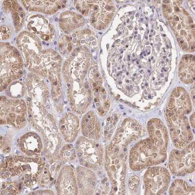 Immunohistochemistry-Paraffin: DELGEF Antibody [NBP2-38366]