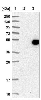 Western Blot: DEM1 Antibody [NBP1-88493]