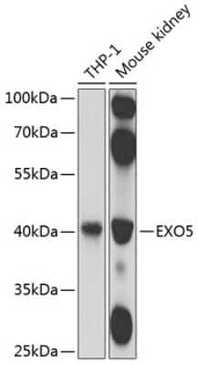 Western Blot: DEM1 AntibodyBSA Free [NBP2-92552]