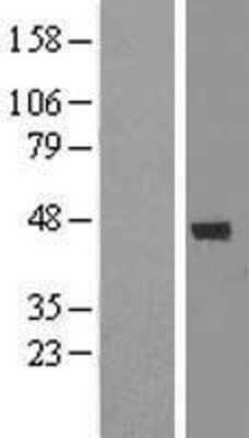 Western Blot: DEM1 Overexpression Lysate [NBL1-08304]