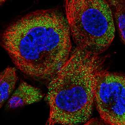 Immunocytochemistry/ Immunofluorescence: DENN/MADD Domain Containing 2D Antibody [NBP2-30448]