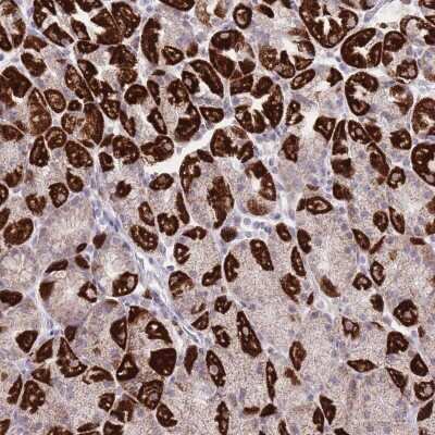 Immunohistochemistry-Paraffin: DENN/MADD Domain Containing 2D Antibody [NBP2-30448]