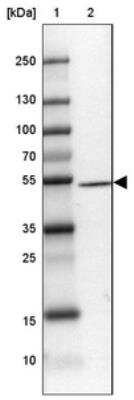 Western Blot: DENN/MADD Domain Containing 2D Antibody [NBP2-30995]