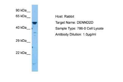 Western Blot: DENN/MADD Domain Containing 2D Antibody [NBP2-84771]