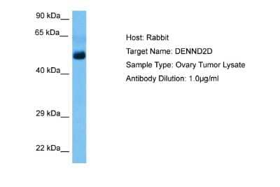 Western Blot: DENN/MADD Domain Containing 2D Antibody [NBP2-84772]