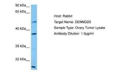 Western Blot: DENN/MADD Domain Containing 2D Antibody [NBP2-84773]