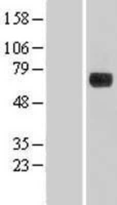 Western Blot: DENND1A Overexpression Lysate [NBL1-09827]