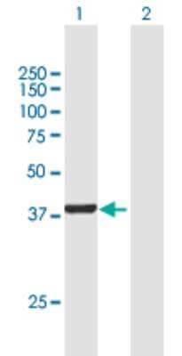 Western Blot: DENND1B Antibody [H00163486-B01P]