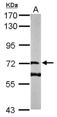 Western Blot: DENND1B Antibody [NBP1-32715]