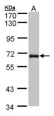 Western Blot: DENND1B Antibody [NBP1-32715]