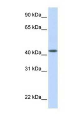 Western Blot: DENND1B Antibody [NBP1-69231]