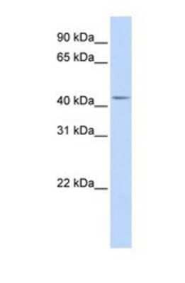 Western Blot: DENND1B Antibody [NBP1-69245]