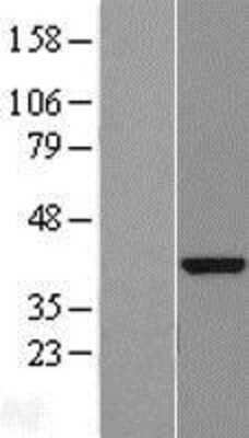 Western Blot: DENND1B Overexpression Lysate [NBL1-08314]