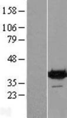 Western Blot: DENND1B Overexpression Lysate [NBP2-05522]