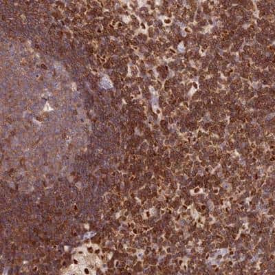 Immunohistochemistry: DENND1C Antibody [NBP1-94051]