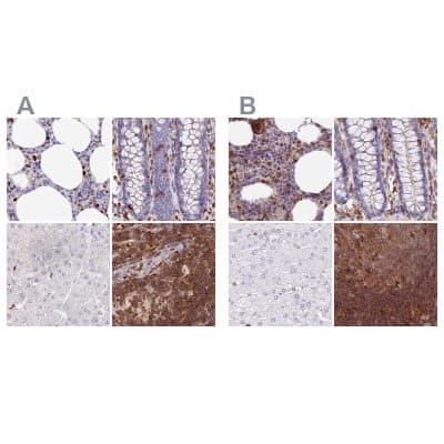 Immunohistochemistry-Paraffin: DENND1C Antibody [NBP1-94051]