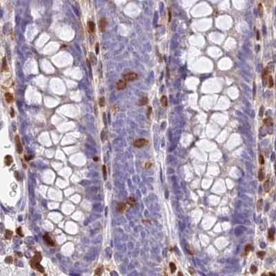 Immunohistochemistry-Paraffin: DENND1C Antibody [NBP1-94051]