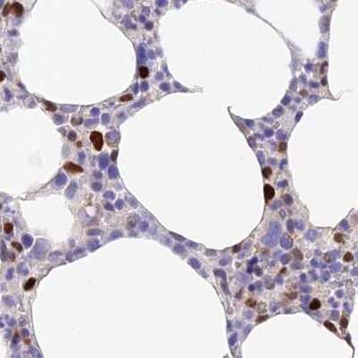 Immunohistochemistry-Paraffin: DENND1C Antibody [NBP1-94051]