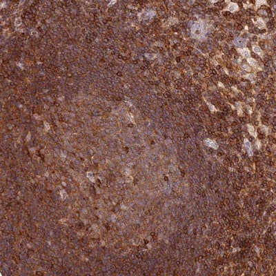 Immunohistochemistry-Paraffin: DENND1C Antibody [NBP1-94052]