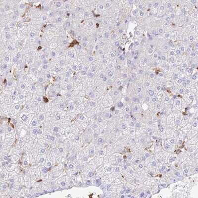 Immunohistochemistry-Paraffin: DENND1C Antibody [NBP1-94052]