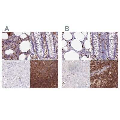 Immunohistochemistry-Paraffin: DENND1C Antibody [NBP1-94052]