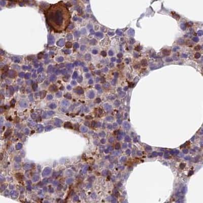 Immunohistochemistry-Paraffin: DENND1C Antibody [NBP1-94052]