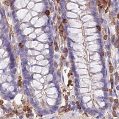 Immunohistochemistry-Paraffin: DENND1C Antibody [NBP1-94052]