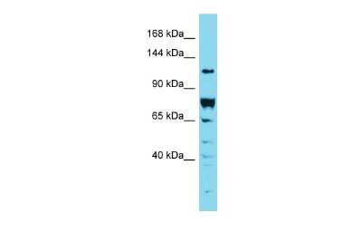 Western Blot: DENND2A Antibody [NBP3-10766]