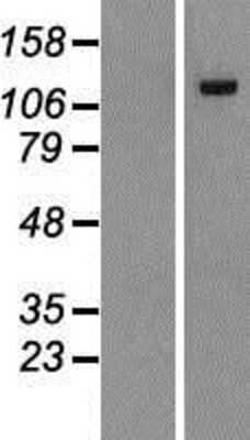 Western Blot: DENND2A Overexpression Lysate [NBP2-07129]