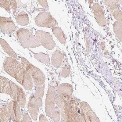 Immunohistochemistry-Paraffin: DENND2C Antibody [NBP2-49159]