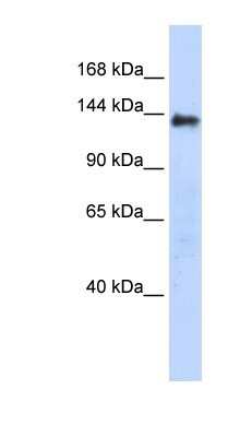 Western Blot: DENND2C Antibody [NBP1-79530]