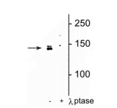 Western Blot: DENND3 [p Ser554] Antibody [NBP2-60771]